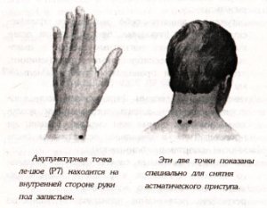 АСТМА