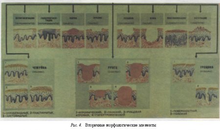 Вторичные морфологические элементы